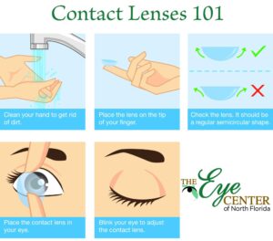 Contact Lenses 101